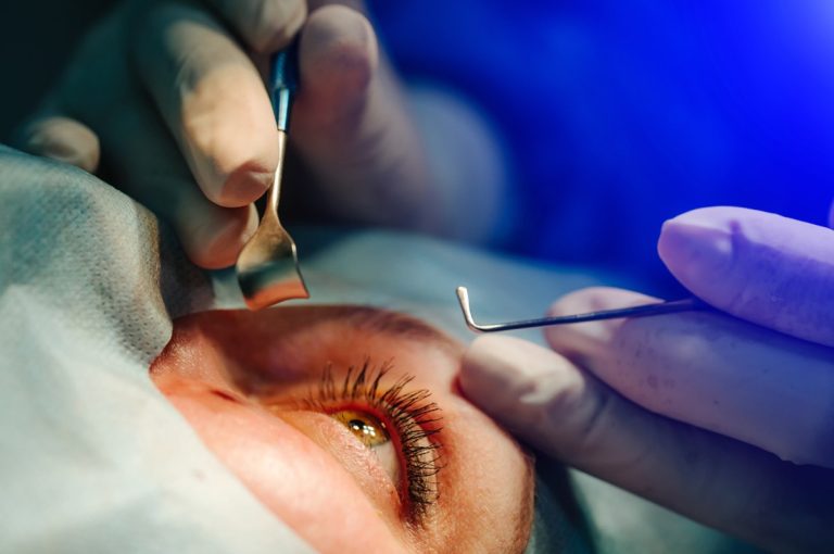 When Is the Right Time to Get Cataract Treatment?