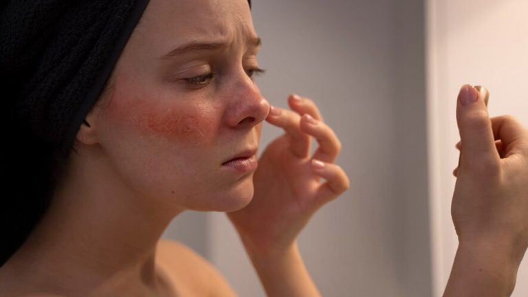 Understanding Modern Approaches to Managing Chronic Skin Conditions